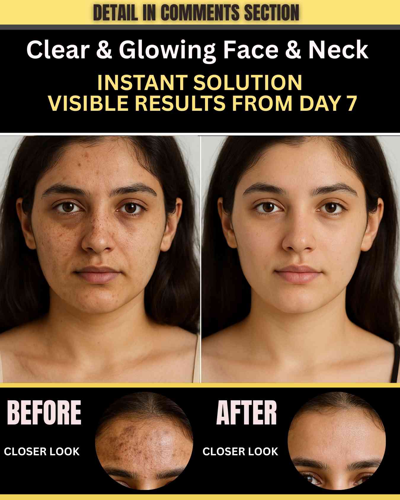 A clear and glowing face and a bright neck change the way your entire appearance feels. The neck often darkens faster because of sweat, friction, sun exposure, and buildup of dead skin.