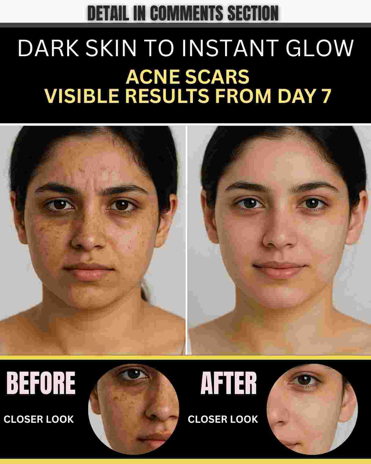 DARK SKIN TO INSTANT GLOW & ACNE SCARS – VISIBLE RESULTS FROM DAY 7