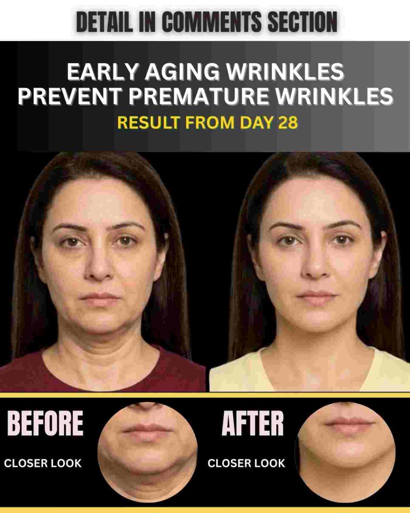 EARLY AGING WRINKLES PREVENT PREMATURE WRINKLES NATURALLY