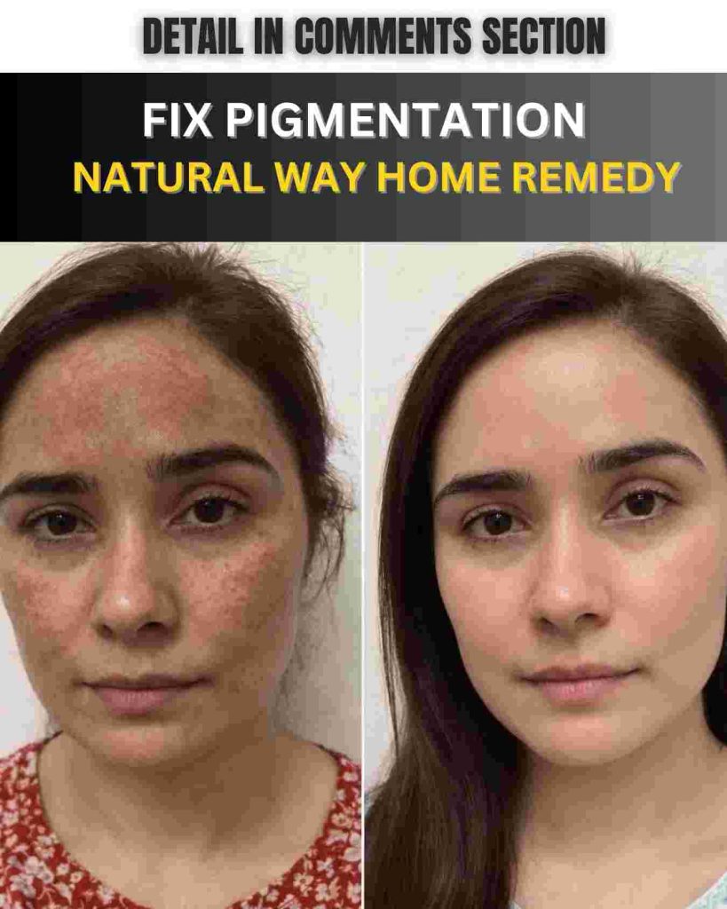 Fix Pigmentation the Natural Way – Home Remedy