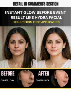 INSTANT GLOW BEFORE EVENT – NATURAL RESULT LIKE HYDRA FACIAL