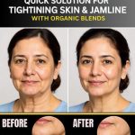 QUICK SOLUTION FOR TIGHTENING SKIN & JAWLINE WITH ORGANIC BLENDS