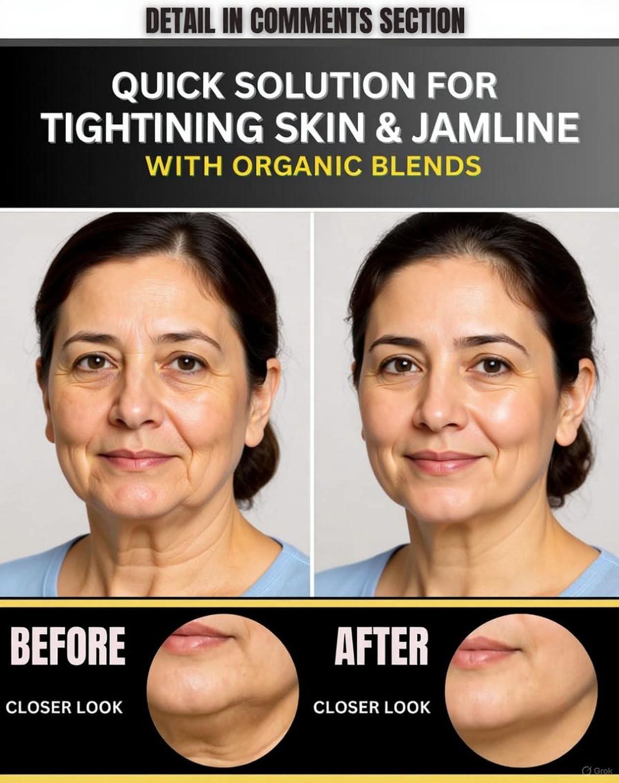 QUICK SOLUTION FOR TIGHTENING SKIN & JAWLINE WITH ORGANIC BLENDS