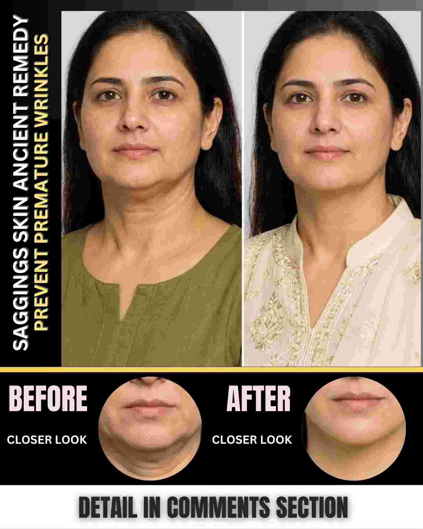 SAGGING SKIN ANCIENT REMEDY – ALSO PREVENTS PREMATURE WRINKLES