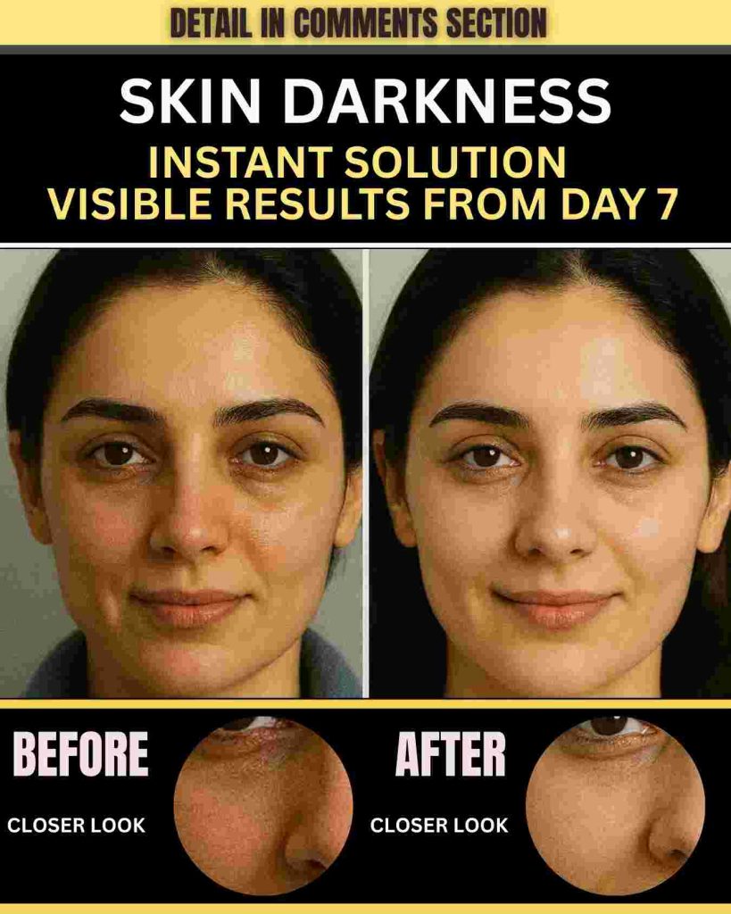 SKIN DARKNESS INSTANT SOLUTION – VISIBLE RESULTS FROM DAY 7