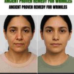 ANCIENT PROVEN REMEDY FOR WRINKLES