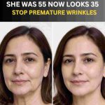 She Was 55, Now Looks 35 — Stop Premature Wrinkles Naturally
