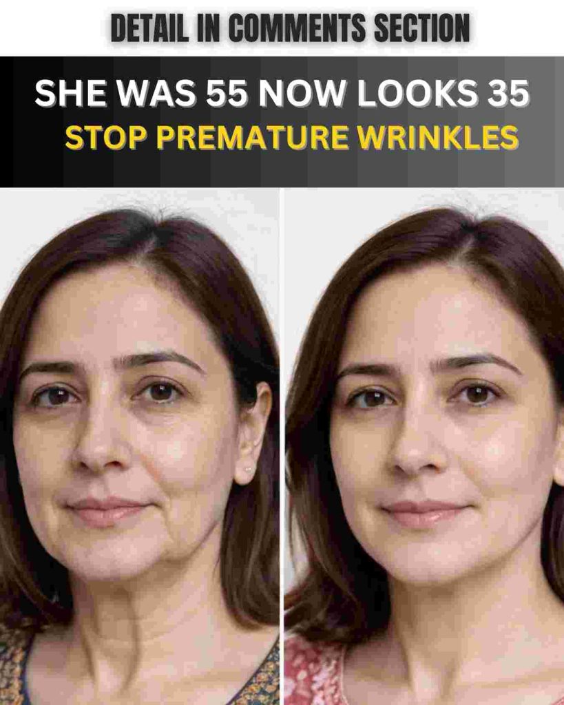 She Was 55, Now Looks 35 — Stop Premature Wrinkles Naturally