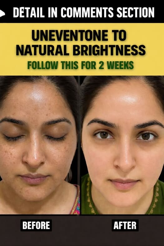 Uneven Skin Tone to Brightness – Natural Remedy