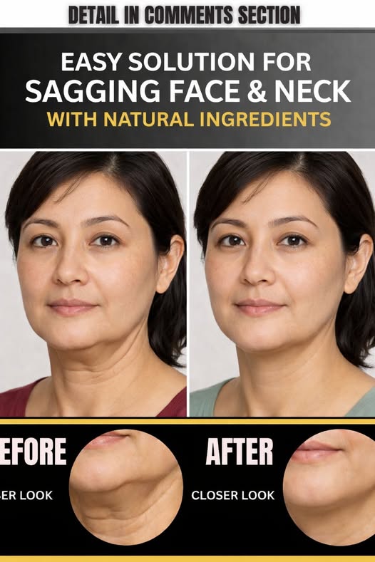 Easy Natural Solution for Sagging Face and Neck