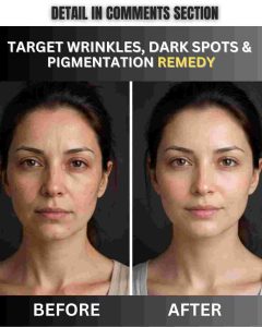 Target Wrinkles, Dark Spots & Pigmentation – Natural Remedy by Skin Type