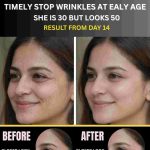 Timely Stop Wrinkles at Early Age – She Is 30 but Looks 50 (Results from Day 14)