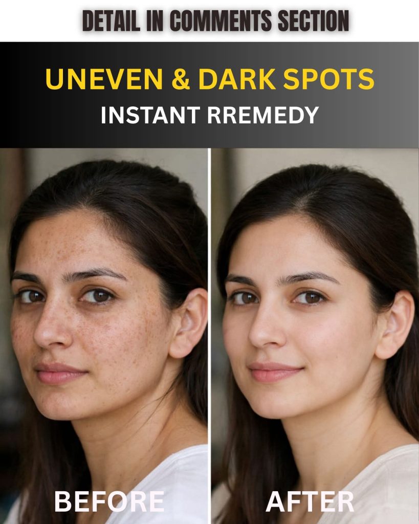 Uneven & Dark Spots Instant Remedy Using Home Ingredients