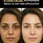 Hydra-Like Facial Using Home Remedies for Glowing Skin