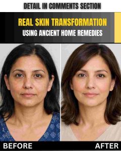 Real Skin Transformation Using Ancient Home Remedies