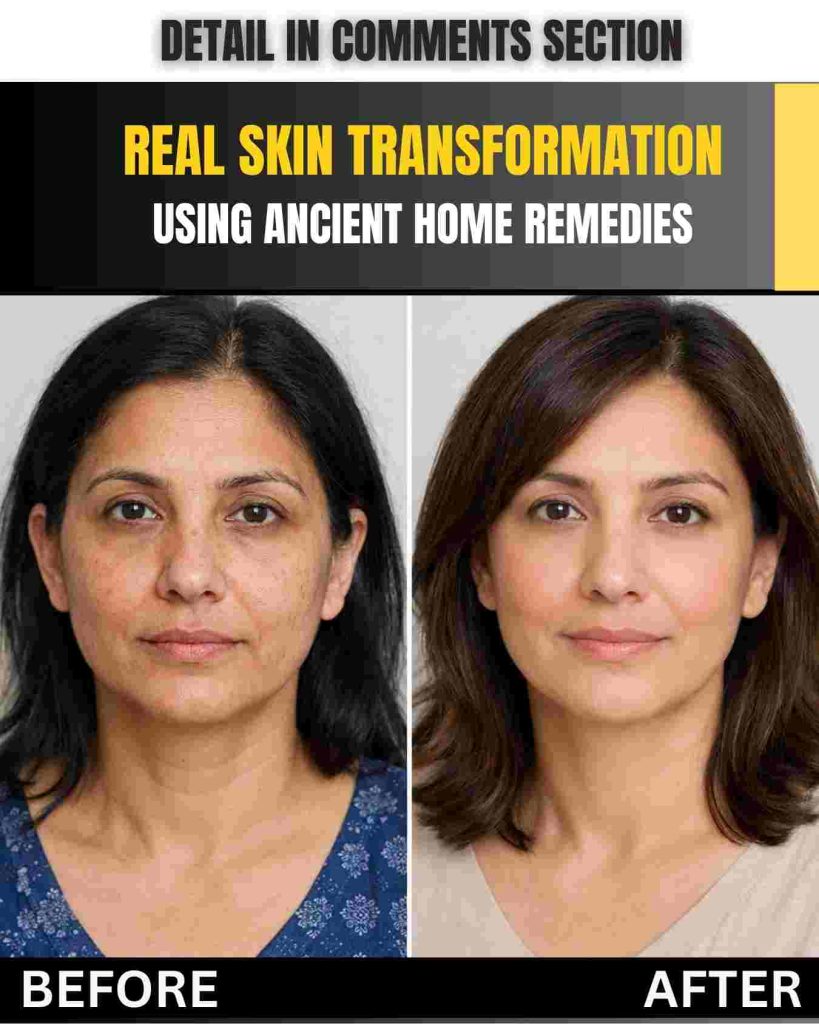 Real Skin Transformation Using Ancient Home Remedies