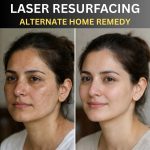 Before You Try Laser Resurfacing, Consider This Natural Home Remedy First