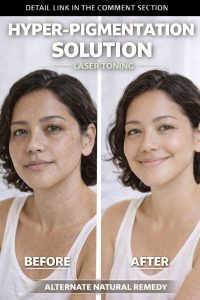 Before You Try Laser Toning for Hyperpigmentation, Consider This Natural Home Remedy First