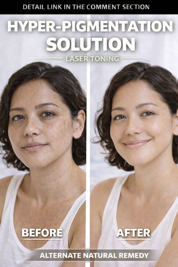 Before You Try Laser Toning for Hyperpigmentation, Consider This Natural Home Remedy First