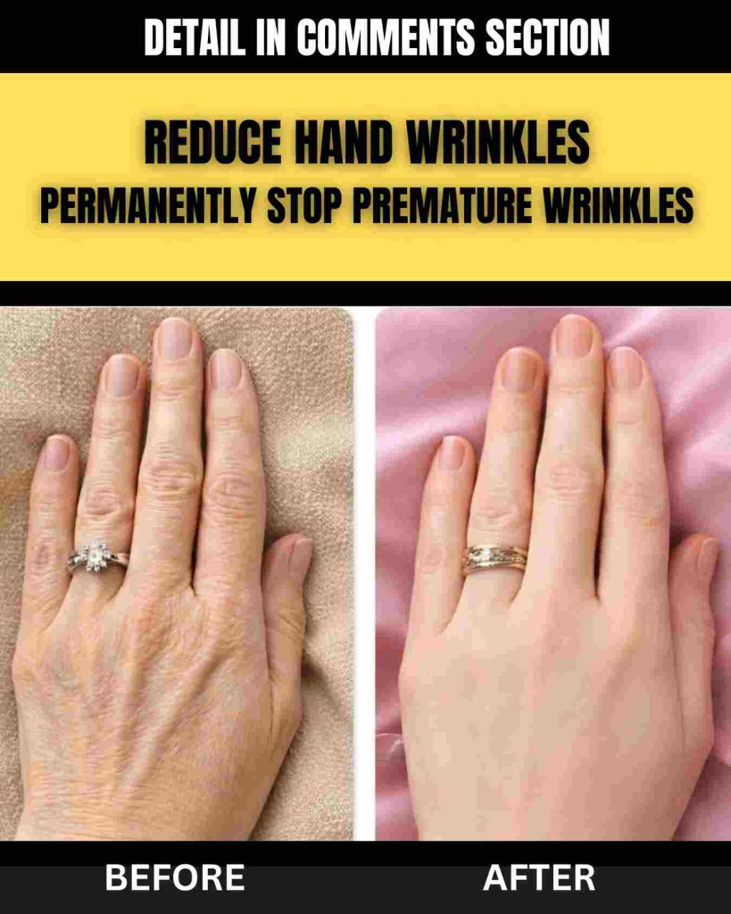 Reduce Hand Wrinkles Naturally & Permanently Stop Premature Aging