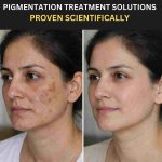 Natural Pigmentation Correction Program – Clear, Even Skin Backed by Science