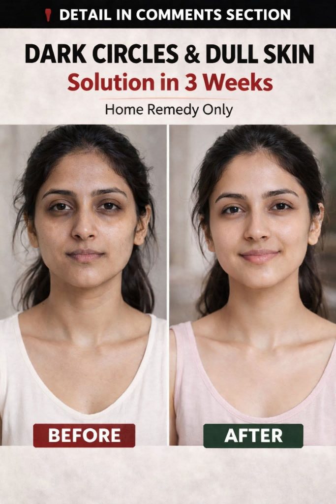 Remove Dark Circles & Dull Skin Naturally in 3 Weeks – Scientifically Backed Remedies by Skin Type