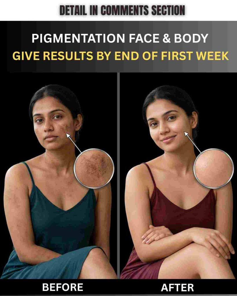 Remove Pigmentation Naturally for Face & Body by Skin Type