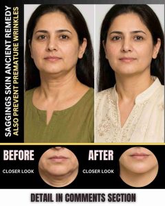 Ancient Natural Remedies to Tighten Sagging Skin and Prevent Premature Wrinkles by Skin Type