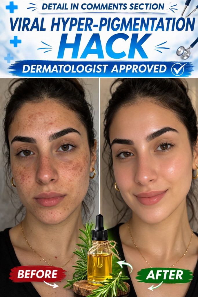 Before You Try Laser Treatment for Hyper-Pigmentation, Consider This Natural Home Remedy First