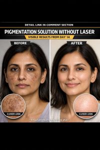 Before You Try Laser Treatment for Pigmentation, Consider This Natural Home Remedy First