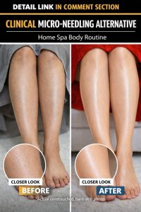 Natural Alternative to Micro-Needling: Home Spa Body Routine for Smooth, Glowing Skin