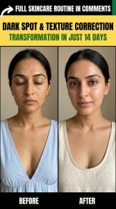 Dark Spot & Texture Correction Natural Remedies by Skin Type
