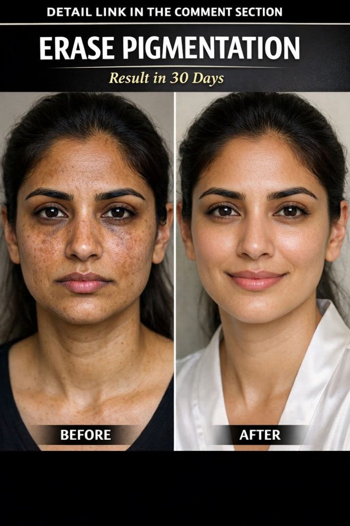 “Erase Pigmentation Naturally at Home Targeted Remedies, Herbal Drinks, Diet Plans, and Exercises for Clear Skin”