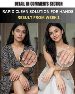 Get Clean, Bright, and Soft Hands Naturally in 1 Week