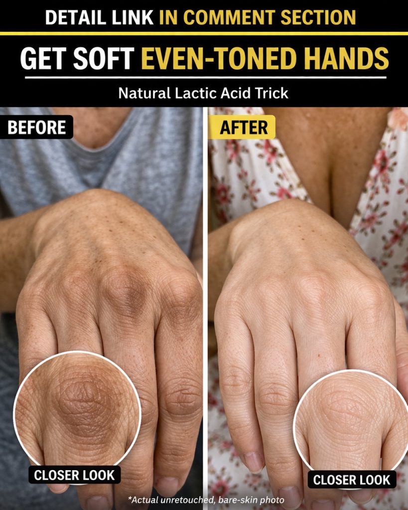 Get Soft, Even-Toned Hands Naturally Lactic Acid-Based Home Remedies, Herbal Drinks, Diet Plans, and Exercises
