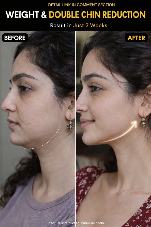 Natural Double Chin Reduction and Jawline Sculpting Guide