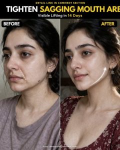 Natural Ways to Lift Sagging Mouth Area Fast