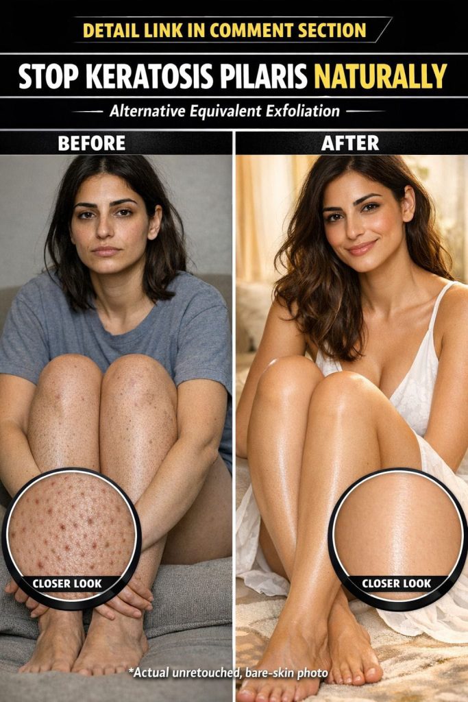 Natural Ways to Smooth Keratosis Pilaris Skin