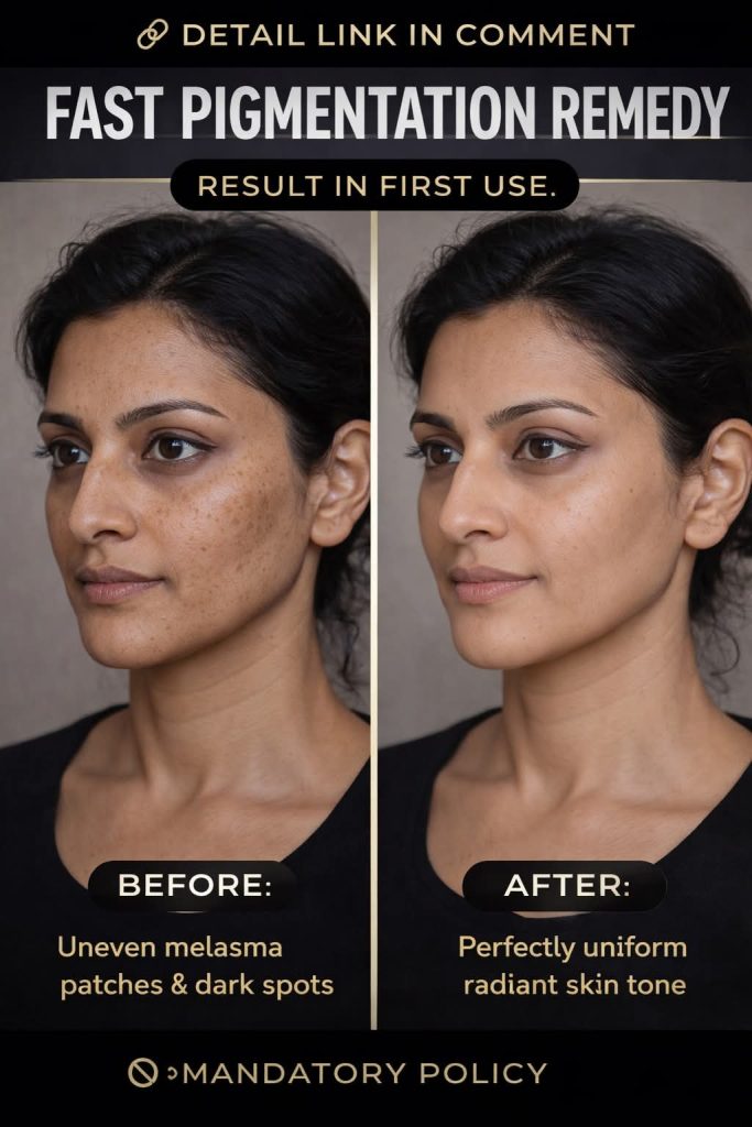 Remove Pigmentation and Dark Spots Naturally at Home with Herbal Remedies, Diet, and Exercise