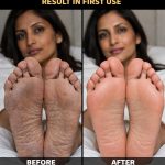Repair Cracked Heels and Get Soft Feet Naturally at Home