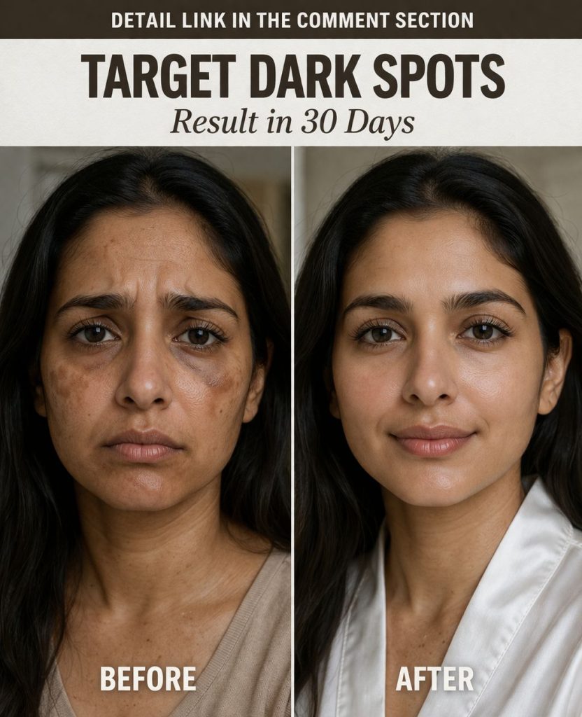 Target Dark Spots Naturally in 30 Days Skin-Type Remedies, Scientific Ingredients, Diet Plans, and Internal Glow Secrets
