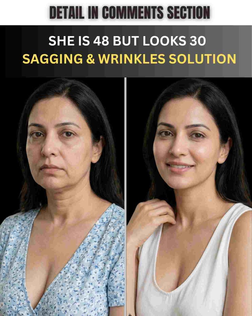 Tighten Sagging Skin and Reduce Wrinkles Naturally by Skin Type