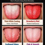 What Your Tongue Reveals About Hidden Health Issues