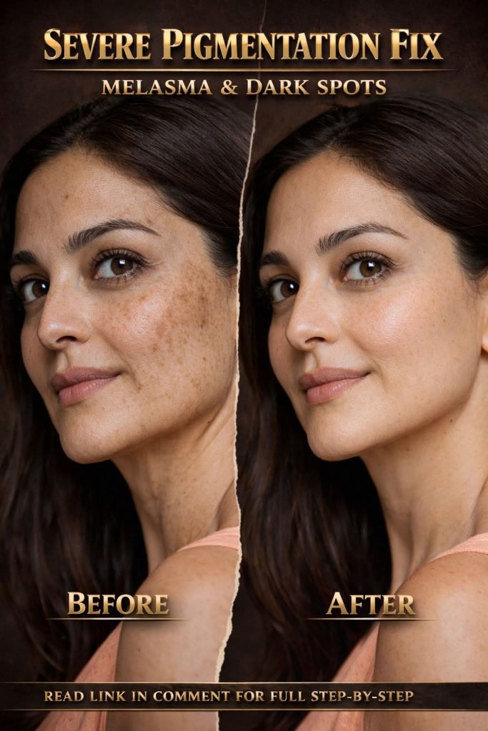Severe Pigmentation Fix: Natural Remedies for Melasma and Dark Spots by Skin Type