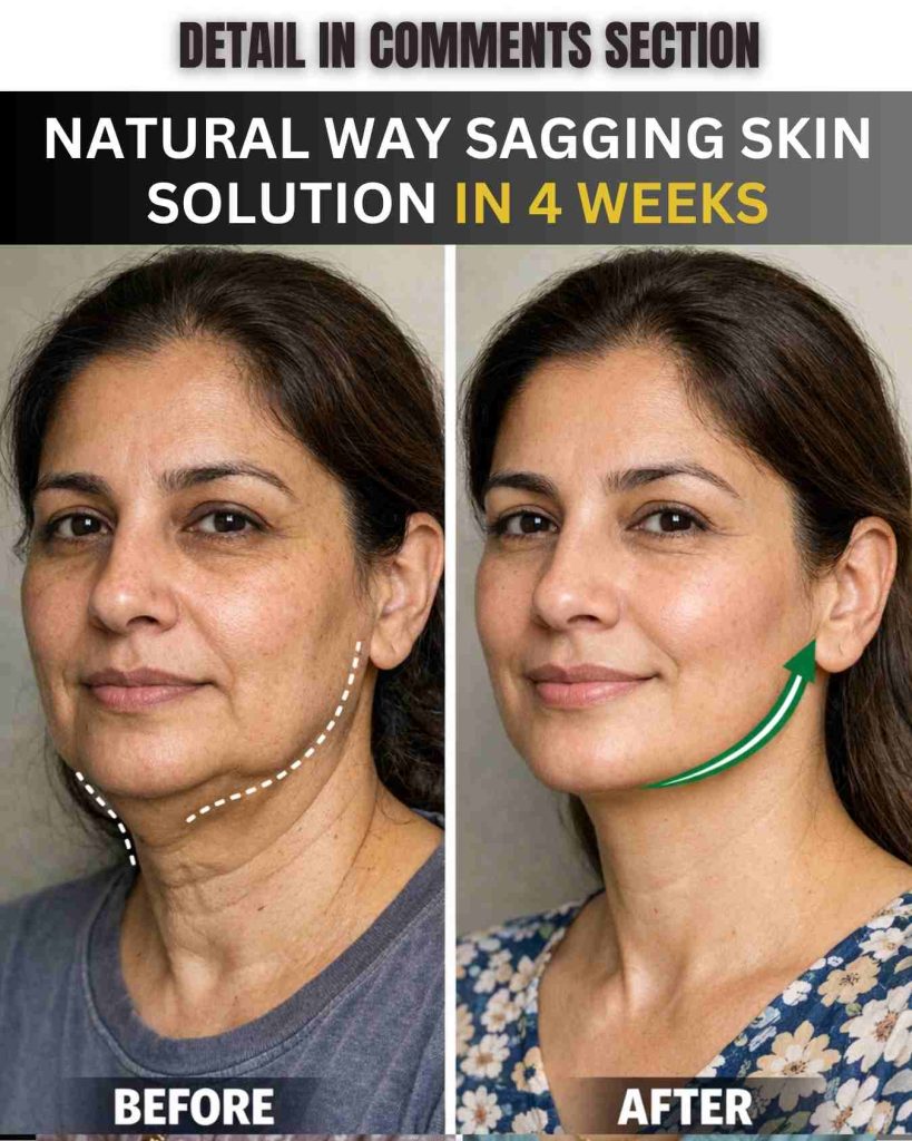 Natural Ways to Tighten Sagging Skin Safely