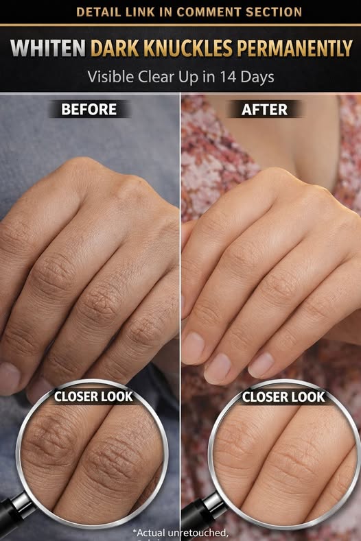 Effective Natural Methods to Lighten Dark Knuckles
