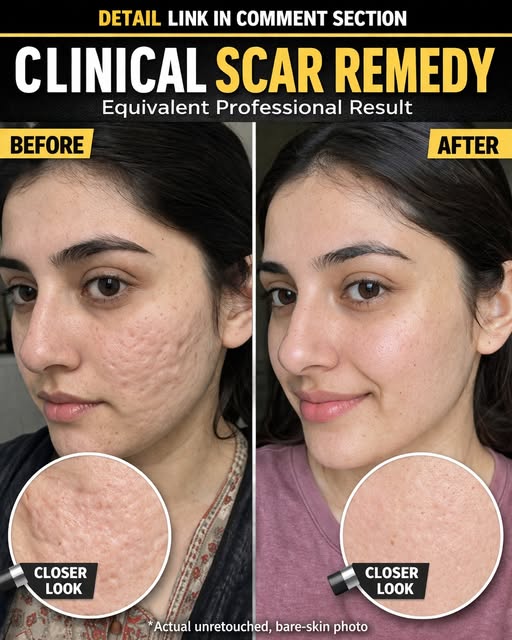 Restore Clear and Healthy Skin Texture Naturally
