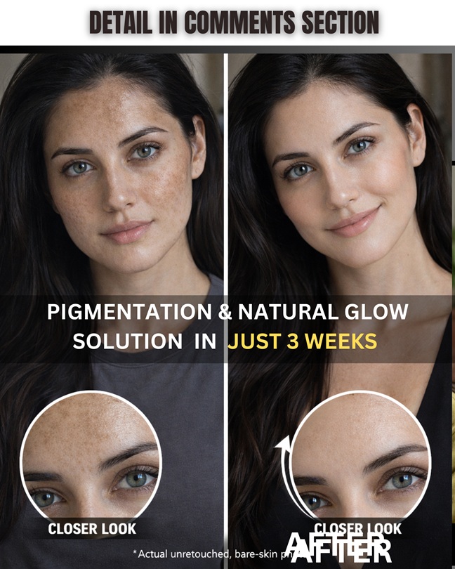 Clear Pigmentation Naturally for Radiant Skin Glow
