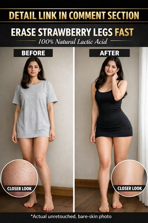 Effective Natural Treatments to Clear Strawberry Legs