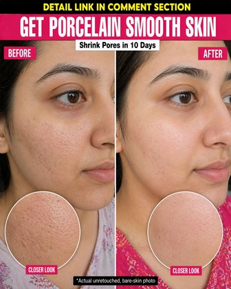How to Minimize Enlarged Pores Naturally Fast